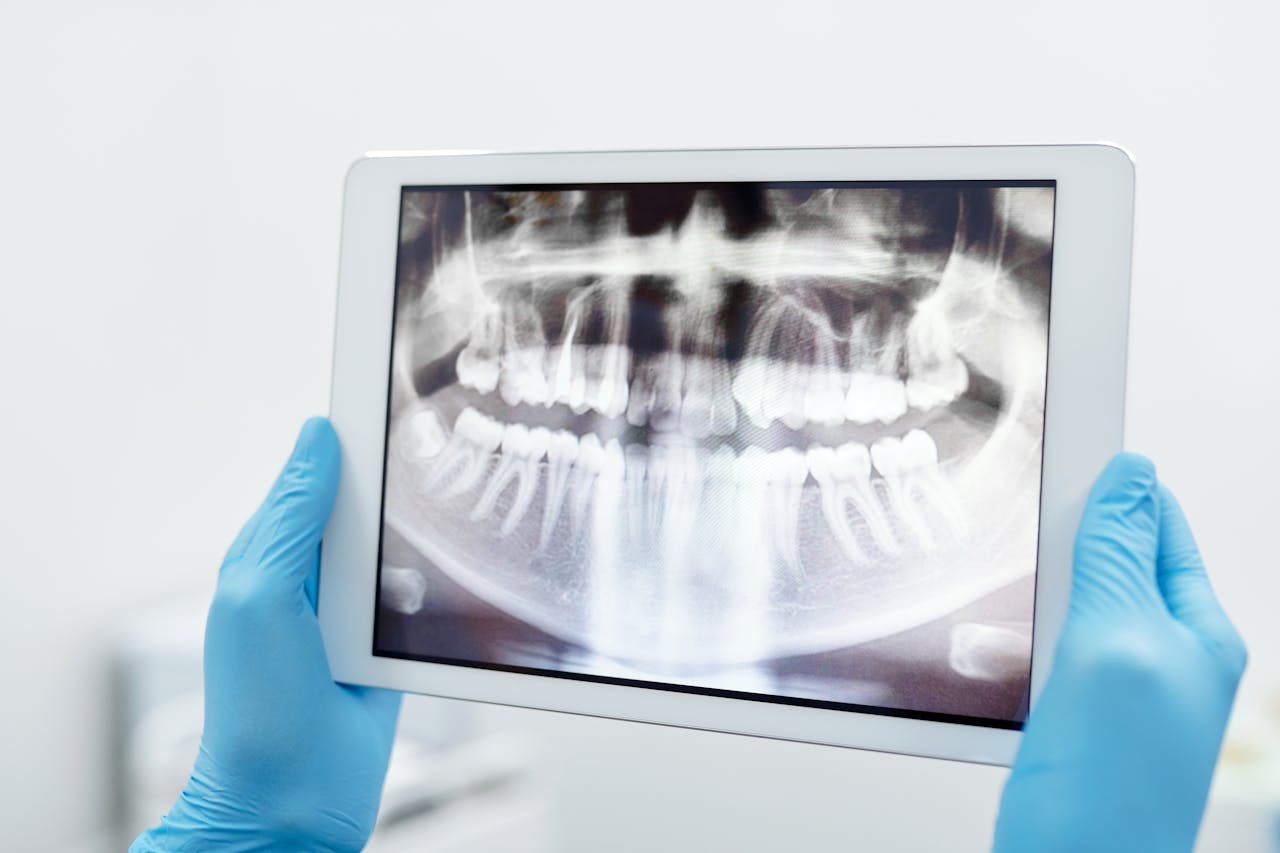 Profissional com luvas azuis segurando um tablet que exibe uma radiografia panorâmica dos dentes de um paciente.