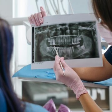 Especialidades da Odontologia: o que diferencia o dentista geral do ortodontista?
